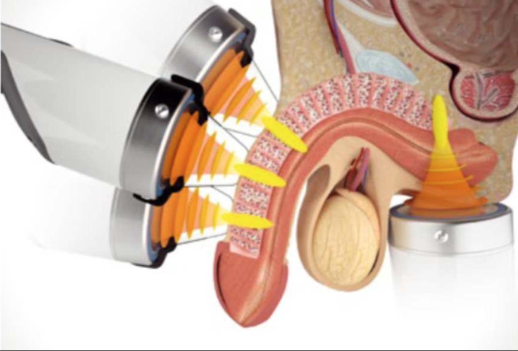 New Cenmade anatomical diagram