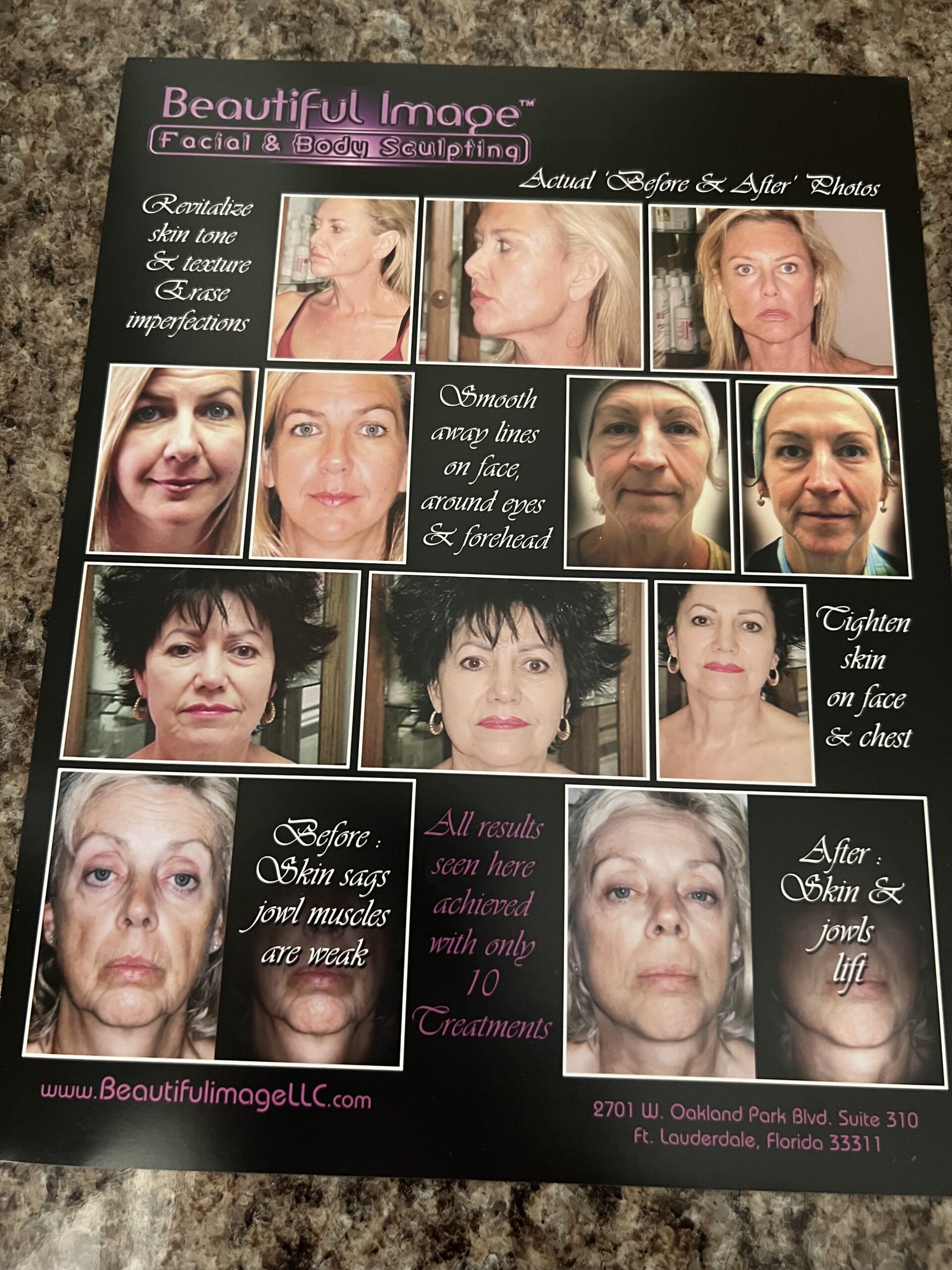 2009 Beautiful Image 900 Microcurrent with Face Handpiece & Body Handpiece - Skin Tightening, Wrinkle Reduction, Sculpting & Contouring - Like New, Perfect Condition - Includes Warranty & Shipping (km/sto)x - Image 16