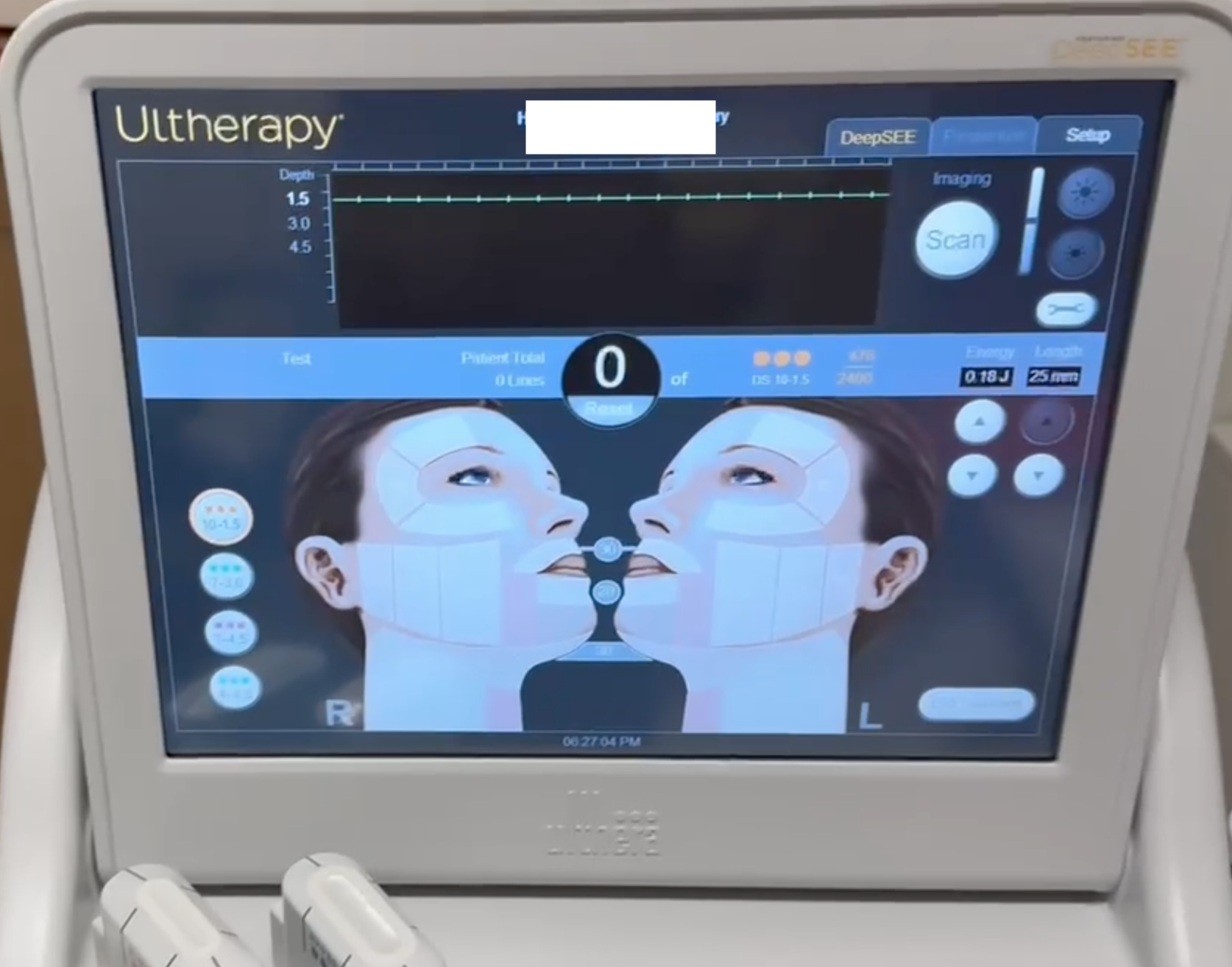 2024 Merz Ulthera Ultherapy Ultrasound Skin Tightening System - with 2024 UH-2 DeepSee Handpiece - PERFECT CONDITION - ONLY USED 10x - Free Shipping & Warranty (km/tan)s - Image 10