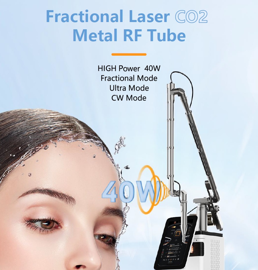 Fractional laser metal RF tube diagram