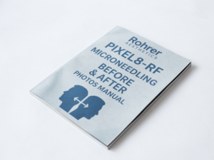 Rohrer Pixel8 Before And After Photos Manual