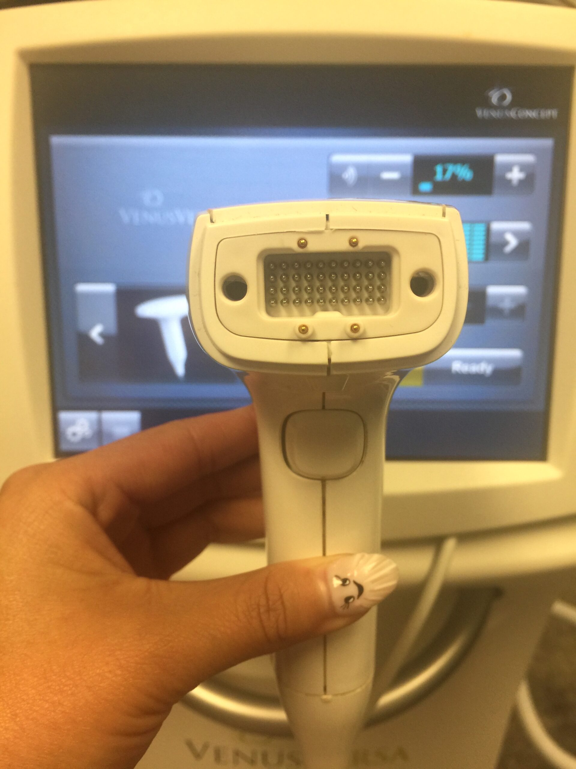 2018 Venus Concepts Versa For Sale: IPL/RF/PEMF + Warranty s - Image 38