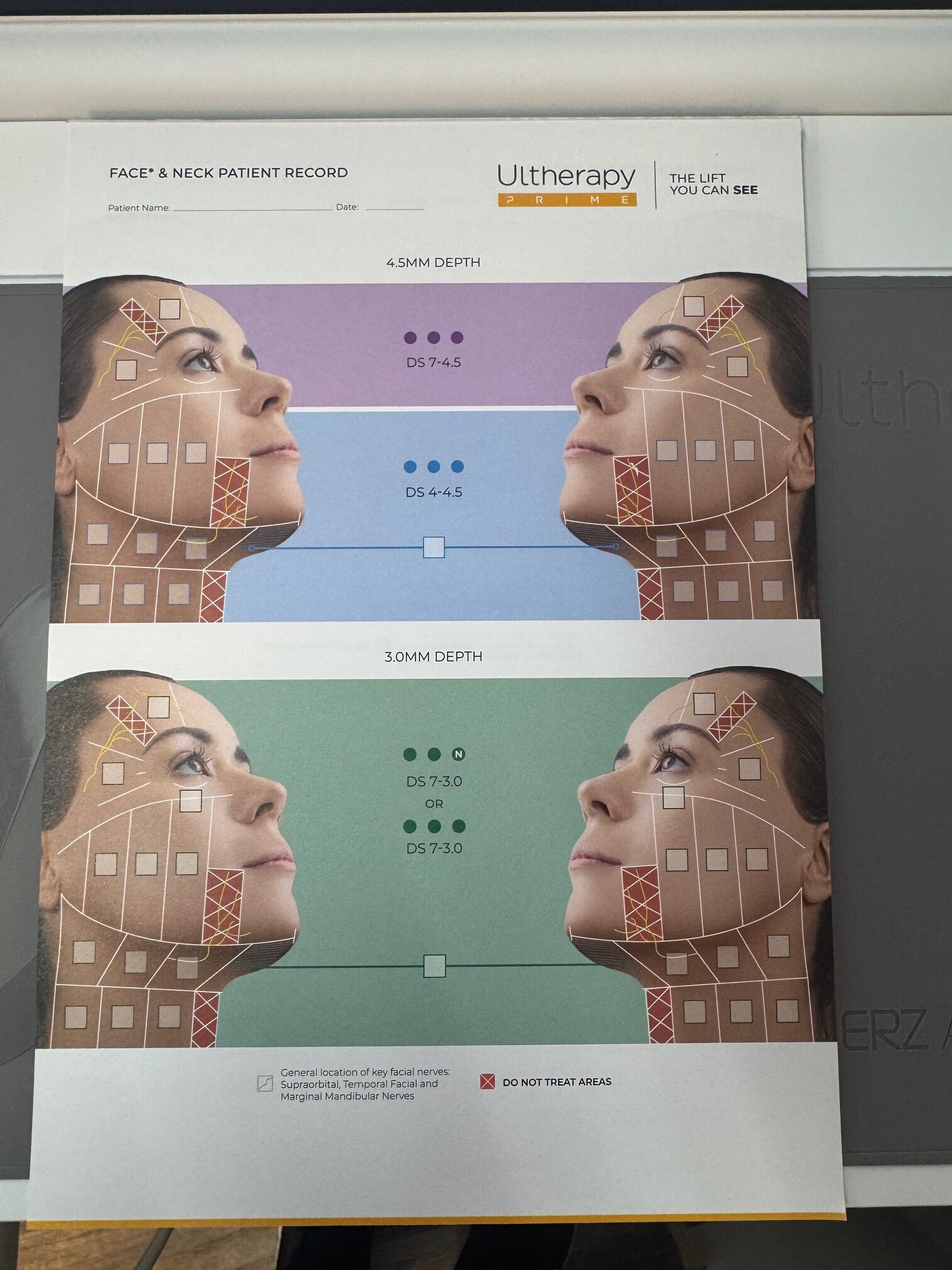 2025 Merz Ulthera Ultherapy Prime Ultrasound Skin Tightening System with UH-2 DeepSee Handpiece - Under Manufacturer Warranty Until 09/2026 -Free Shipping & Warranty (km/dol)s - Image 19