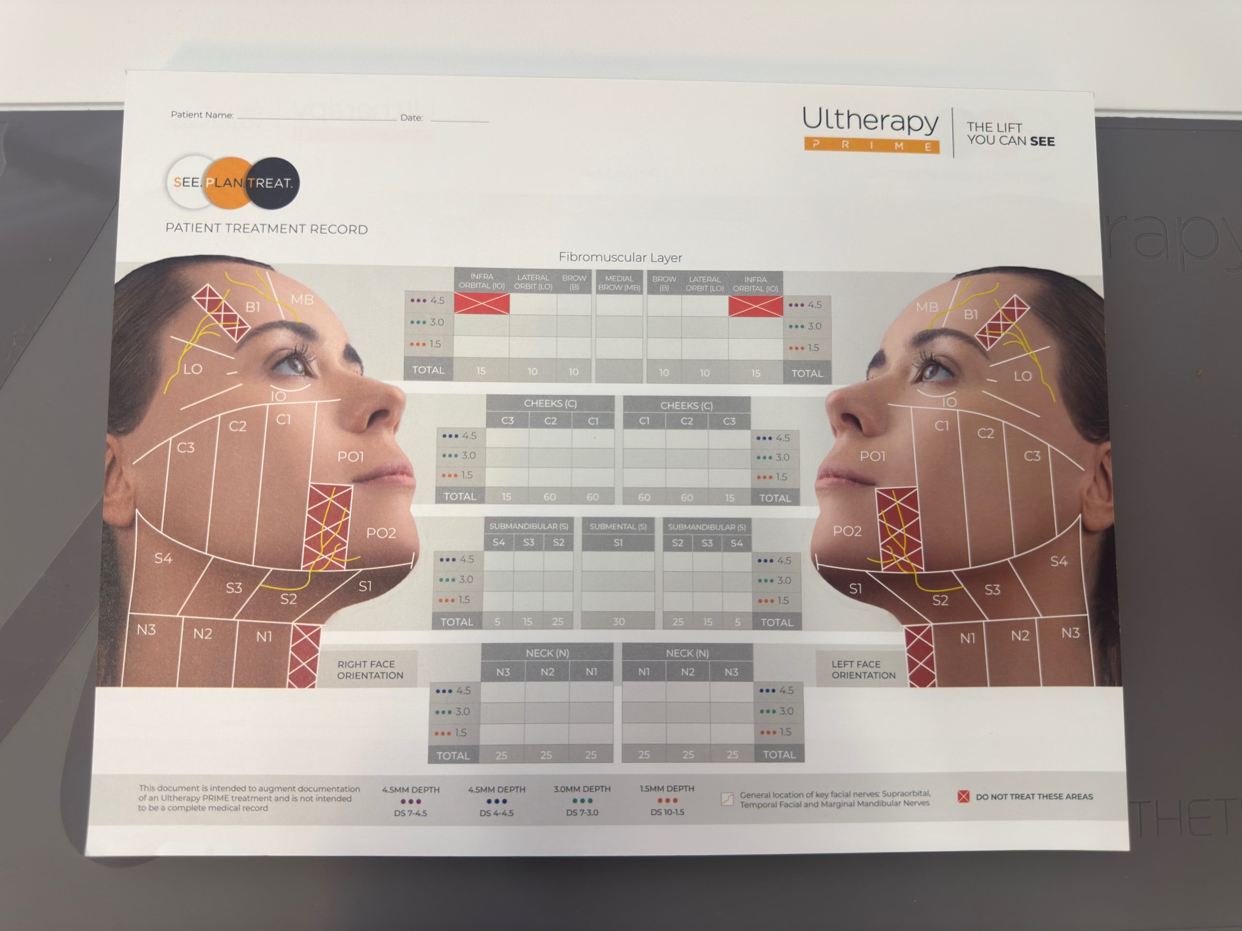 2025 Merz Ulthera Ultherapy Prime Ultrasound Skin Tightening System with UH-2 DeepSee Handpiece - Under Manufacturer Warranty Until 09/2026 -Free Shipping & Warranty (km/dol)s - Image 21