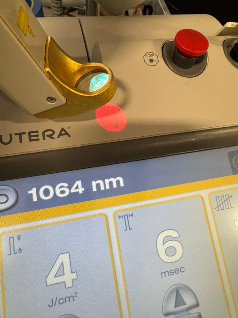 2016 Cutera Excel HR 1064nm + 755nm For Sale + Warranty - Image 6
