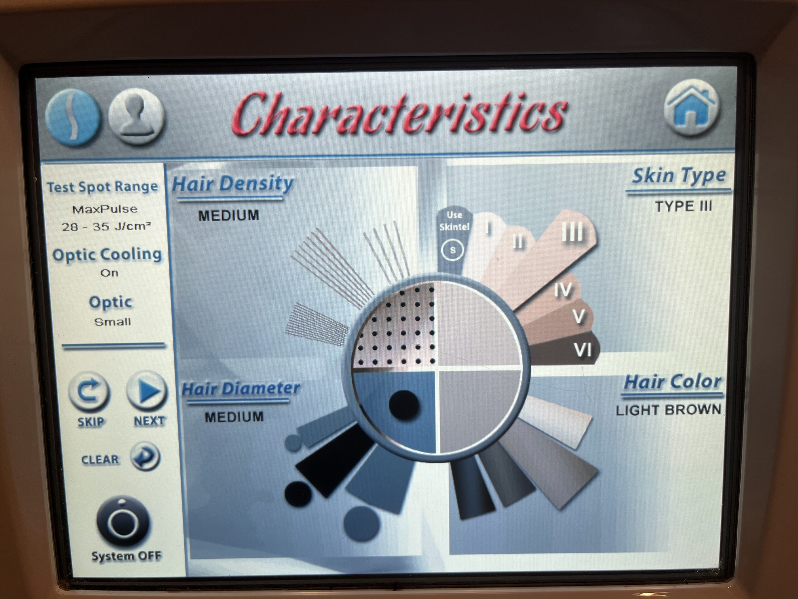Vectus characteristics screen display
