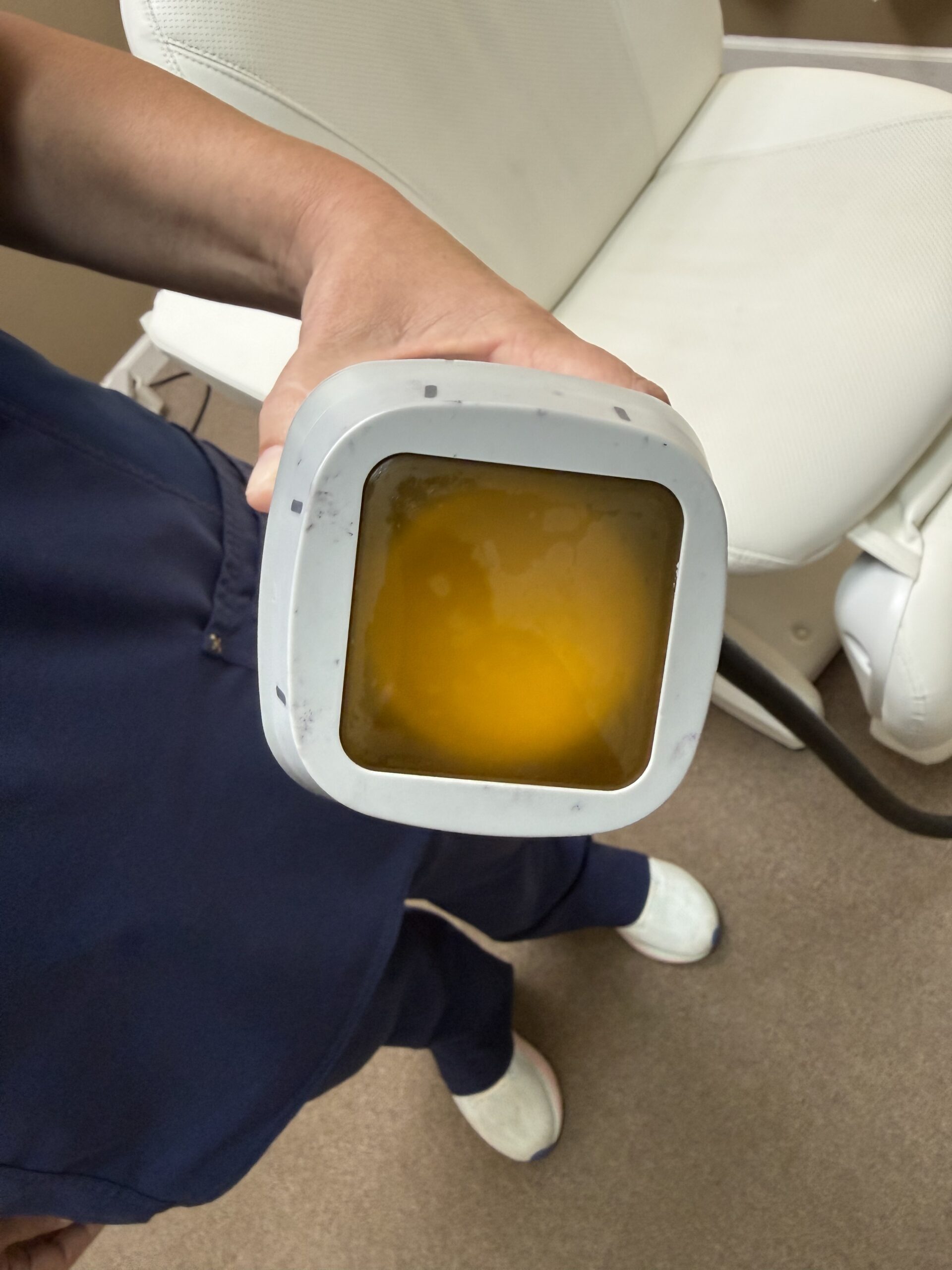 2022 Jeisys LIPOcel High-Intensity Focused Ultrasound (HIFU) For Sale - Image 10
