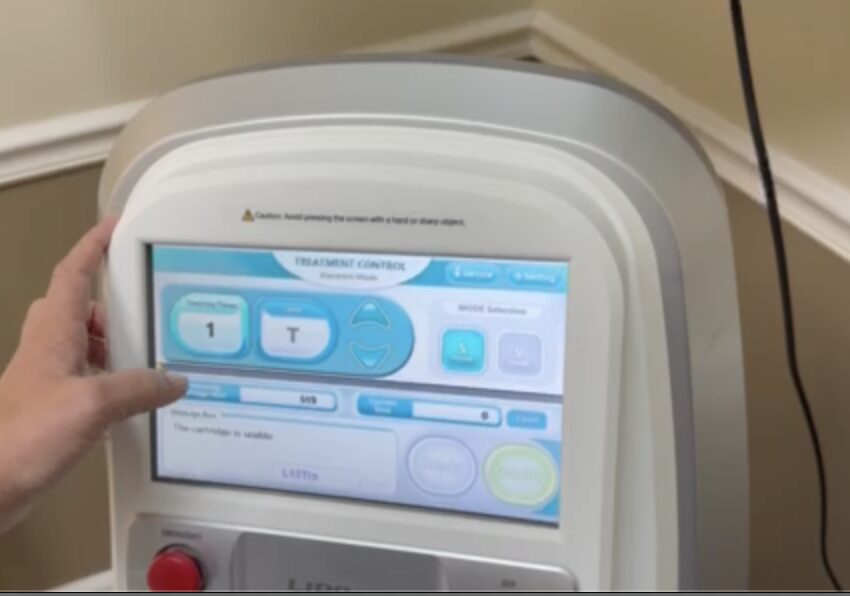 2022 Jeisys LIPOcel High-Intensity Focused Ultrasound (HIFU) For Sale - Image 6