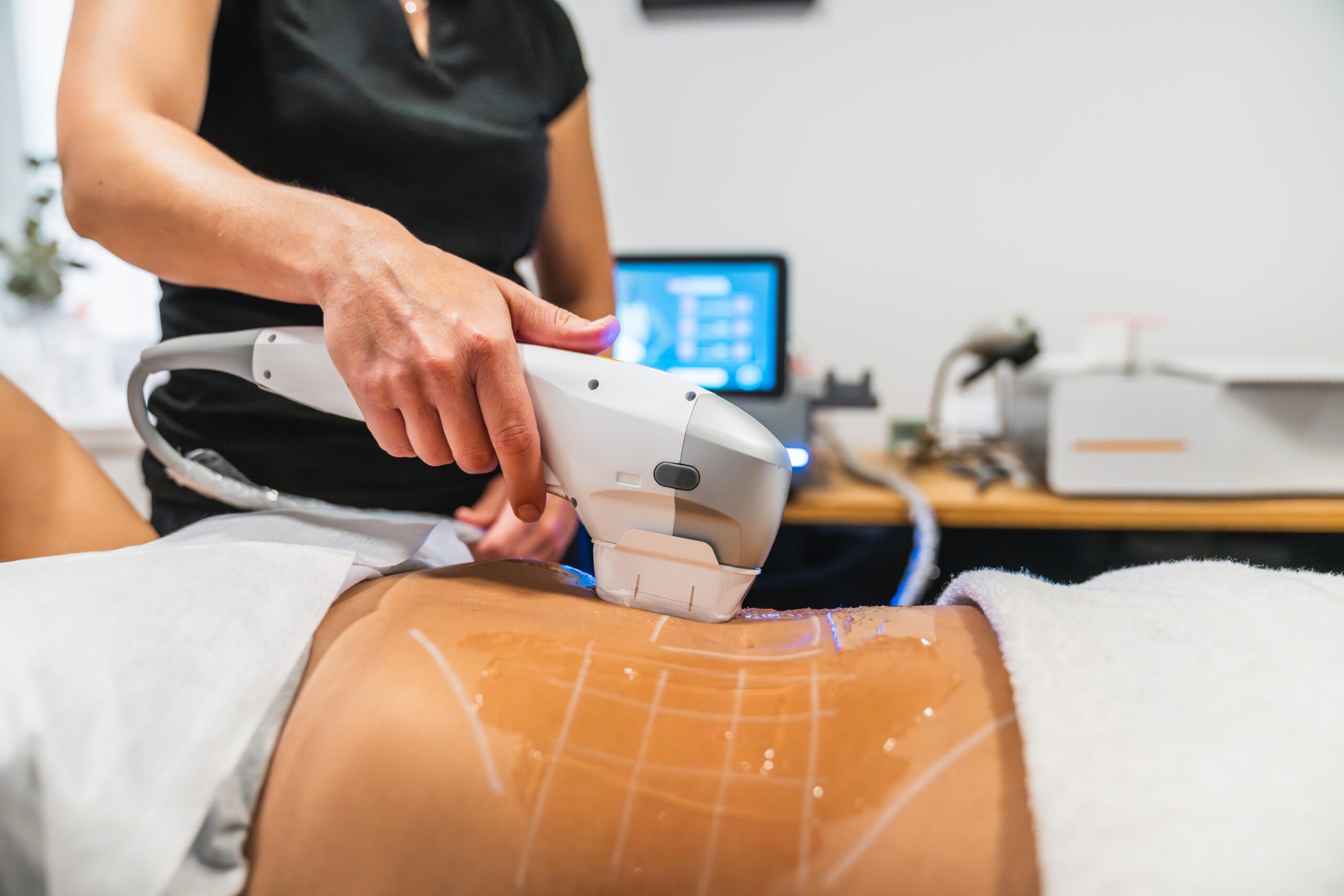 2022 Jeisys LIPOcel High-Intensity Focused Ultrasound (HIFU) For Sale - Image 11