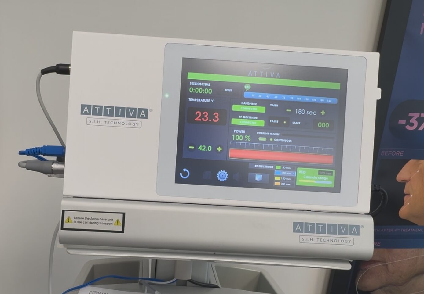 2024 Attiva RF For Sale - Under Skin RF + Warranty - Image 14